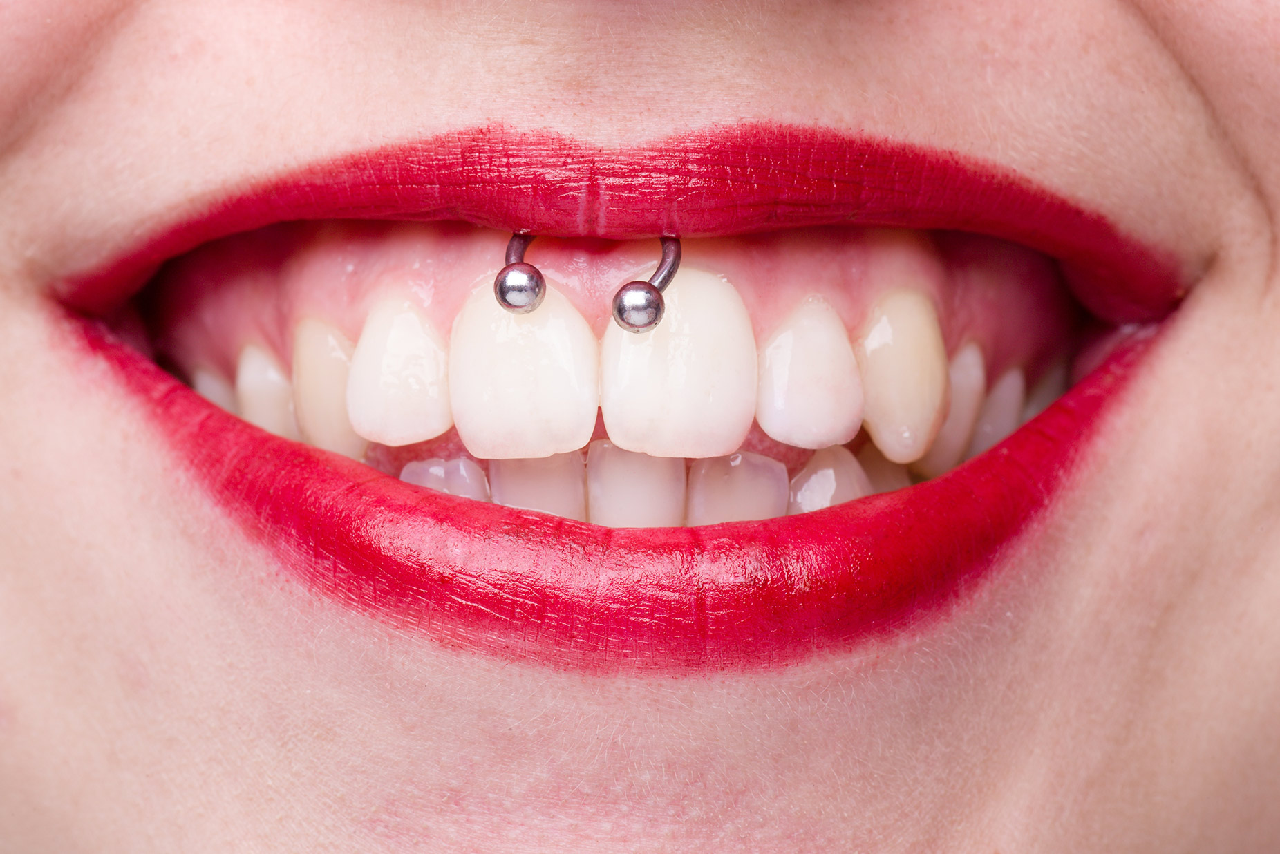 Los piercings orales y sus impactos en nuestra salud. Clínica Ferrús