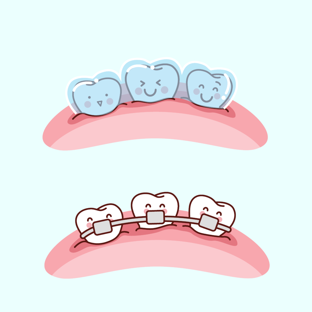 Brackets vs Invisalign Clínica Ferrús